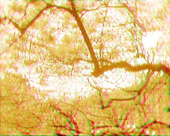 Die Mahnolienbluete 2005 mit dem Handy in 3 d fotografiert