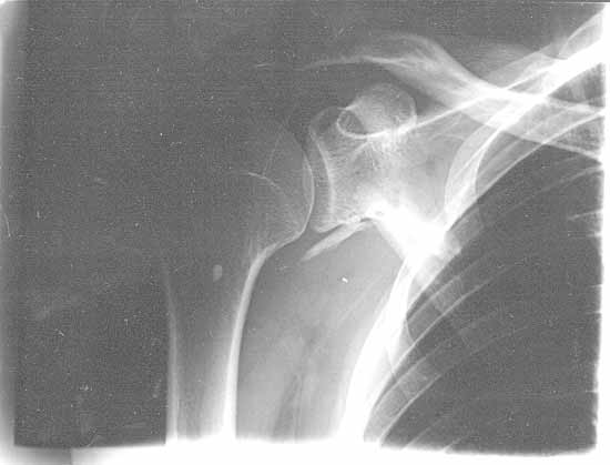 und dann les ich wieder vor